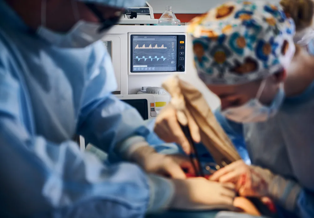Chirurgiens au bloc opératoire, moniteur du patient au premier plan
